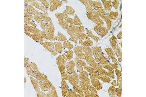 Immunohistochemistry of paraffin-embedded rat heart using SYK Antibody (ABIN5971150) at dilution of 1/100 (40x lens). (SYK 抗体)