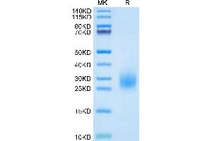 Plasminogen Activator, Urokinase Receptor (PLAUR) (AA 214-305) protein (His tag)