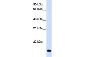 WB Suggested Anti-RNF185 Antibody Titration:  0. (RNF185 抗体  (Middle Region))