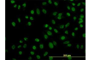 Immunofluorescence of monoclonal antibody to ZNF143 on HeLa cell. (ZNF143 抗体  (AA 1-626))