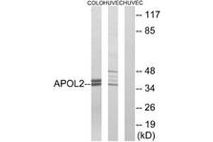 Western blot analysis of extracts from HuvEc/COLO cells, using APOL2 Antibody. (Apolipoprotein L 2 抗体  (AA 191-240))