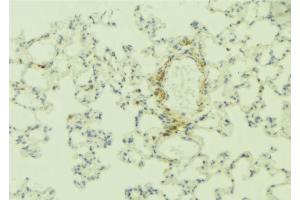 ABIN6268893 at 1/100 staining Human lung tissue by IHC-P. (Integrin beta 4 抗体  (C-Term))