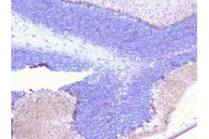 IHC analysis of PCDH15 using anti-PCDH15 antibody (ABIN6719362).