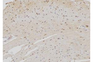 ABIN6259132 and ABIN6273372 at 1/100 staining Rat heart tissue by IHC-P. (NOC4L 抗体  (Internal Region))