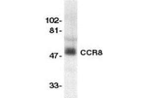 Image no. 1 for anti-Chemokine (C-C Motif) Receptor 8 (CCR8) (AA 183-201) antibody (ABIN201969) (CCR8 抗体  (AA 183-201))