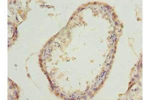 Immunohistochemistry of paraffin-embedded human testis tissue using ABIN7175778 at dilution of 1:100 (WDR61 抗体  (AA 2-305))
