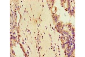 Immunohistochemistry (IHC) image for anti-DEAH (Asp-Glu-Ala-His) Box Polypeptide 33 (DHX33) (AA 116-357) antibody (ABIN7145002)