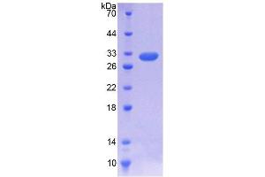 SDS-PAGE analysis of Rat IL7R Protein. (IL7R 蛋白)