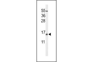 Western blot analysis of KCE1L Antibody (Center) (ABIN653619 and ABIN2842976) in NCI- cell line lysates (35 μg/lane). (KCNE1-Like 抗体  (AA 67-96))