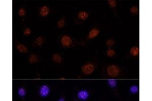 Immunofluorescence analysis of L-929 cells using GLI2 Polyclonal Antibody at dilution of 1:100. (GLI2 抗体)