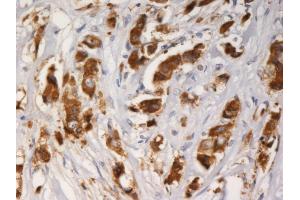 Immunohistochemistry staining of AGR3 with mouse monoclonal AGR3.