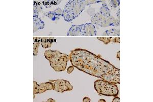 Immunohistochemistry (IHC) image for anti-Insulin Receptor (INSR) (C-Term) antibody (ABIN6254165) (Insulin Receptor 抗体  (C-Term))