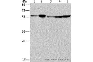 Western blot analysis of Hela, 293T, A549, HT-29 and K562 cell, using NUP50 Polyclonal Antibody at dilution of 1:200 (NUP50 抗体)