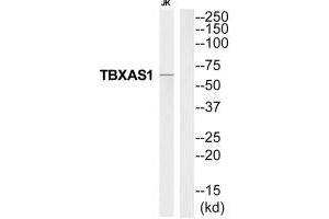 Western blot analysis of extracts from Jurkat cells, using THAS antibody. (TBXAS1 抗体  (C-Term))