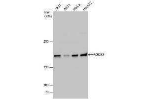 WB Image ROCK2 antibody detects ROCK2 protein by western blot analysis. (ROCK2 抗体)
