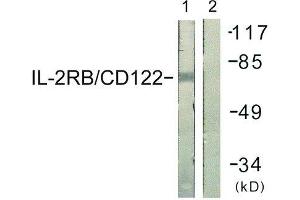 Western Blotting (WB) image for anti-Interleukin 2 Receptor, beta (IL2RB) (Tyr364) antibody (ABIN1848052) (IL2 Receptor beta 抗体  (Tyr364))