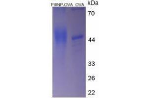 Image no. 1 for Procollagen III N-Terminal Propeptide (PIIINP) (N-Term) peptide (Ovalbumin) (ABIN5666355) (Procollagen III N-Terminal Propeptide (PIIINP) (N-Term) peptide (Ovalbumin))