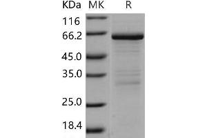 Western Blotting (WB) image for Matrix Metallopeptidase 8 (Neutrophil Collagenase) (MMP8) protein (ABIN7320257) (MMP8 蛋白)