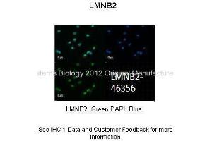 Researcher: Dr. (Lamin B2 抗体  (N-Term))