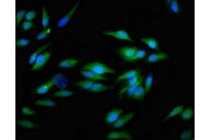 Immunofluorescent analysis of Hela cells using ABIN7156468 at dilution of 1:100 and Alexa Fluor 488-congugated AffiniPure Goat Anti-Rabbit IgG(H+L) (CD51 抗体  (AA 775-885))
