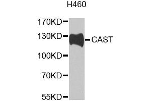 Western blot analysis of extracts of H460 cells, using CAST antibody (ABIN2650901) at 1:1000 dilution. (Calpastatin 抗体)
