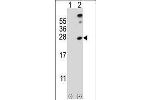 Western Blotting (WB) image for anti-SUMO/sentrin Specific Peptidase Family Member 8 (SENP8) (AA 4-35), (N-Term) antibody (ABIN388073)