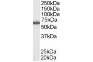 Image no. 1 for anti-DEAD (Asp-Glu-Ala-Asp) Box Polypeptide 5 (DDX5) (C-Term) antibody (ABIN374414) (DDX5 抗体  (C-Term))