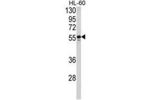 Western blot analysis of NR1H2 Antibody (N-term) in HL-60 cell line lysates (35ug/lane). (NR1H2 抗体  (N-Term))