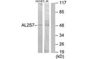 Western blot analysis of extracts from Jurkat/HuvEc cells, using AL2S7 Antibody. (Cyclin-Dependent Kinase 15 (ALS2CR7) (AA 261-310) 抗体)