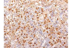 Formalin-fixed, paraffin-embedded human Pituitary Gland stained with ACTH Monoclonal Antibody (2F6). (POMC 抗体  (AA 1-24))