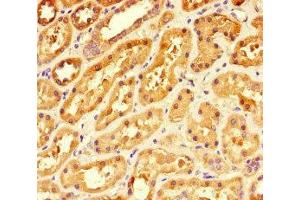 Immunohistochemistry of paraffin-embedded human kidney tissue using ABIN7142008 at dilution of 1:100 (PDK4 抗体  (AA 143-333))