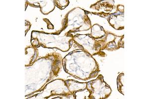 Immunohistochemistry of paraffin-embedded Human placenta using TROP-2 antibody (ABIN7271103) at dilution of 1:2700 (40x lens).