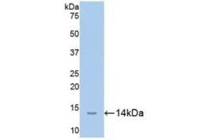 Detection of Recombinant CEACAM1, Mouse using Polyclonal Antibody to Carcinoembryonic Antigen Related Cell Adhesion Molecule 1 (CEACAM1) (CEACAM1 抗体  (AA 35-143))