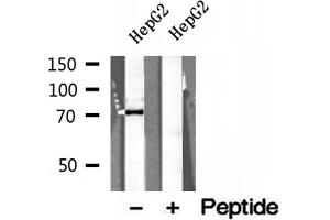 Western blot analysis of extracts of HepG2 cells, using ERp72 antibody. (PDIA4 抗体  (Internal Region))