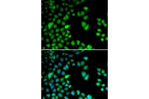 Immunofluorescence (IF) image for anti-Ribosomal Protein S6 Kinase, 90kDa, Polypeptide 3 (RPS6KA3) antibody (ABIN1876624) (RPS6KA3 抗体)