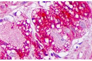 Anti-TRPV3 antibody IHC staining of human colon, ganglion. (TRPV3 抗体  (AA 458-474))