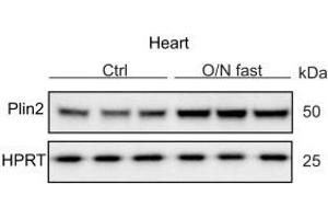 Regulation of Plin2: Immunoblot analysis of Plin2 (ABIN285650) using protein lysates from control (refed) and O/N fasted C57Bl/6N mice hearts (n = 3). (ADRP 抗体  (N-Term))
