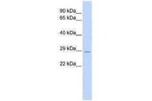 TRIM55 antibody used at 1 ug/ml to detect target protein. (TRIM55 抗体  (Middle Region))