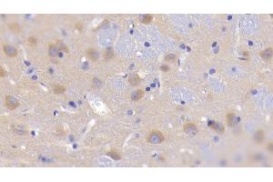 Detection of GKRP in Rat Cerebrum Tissue using Polyclonal Antibody to Glucokinase Regulatory Protein (GKRP) (GCKR 抗体  (AA 90-286))