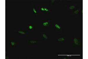 Immunofluorescence of purified MaxPab antibody to TCEB3 on HeLa cell.