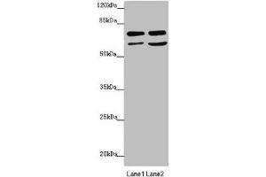 Western blot All lanes: VPS33B antibody at 2. (VPS33B 抗体  (AA 348-617))