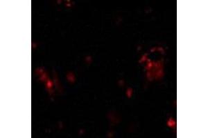 Immunofluorescence of DcR1 in rat liver tissue with AP30279PU-N DcR1 antibody at 10 μg/ml. (DcR1 抗体)