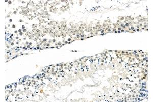 ABIN6263064 and ABIN6272512 at 1/100 staining Rat testis tissue by IHC-P. (MAGEB3 抗体  (N-Term))