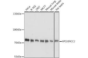 Western blot analysis of extracts of various cell lines, using XPD/ERCC2 antibody (ABIN7267056) at 1:1000 dilution. (ERCC2 抗体  (AA 1-180))