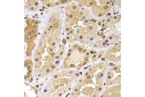 Immunohistochemistry of paraffin-embedded human kidney using PHF21B antibody. (PHF21B 抗体  (AA 322-531))
