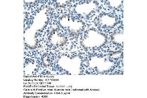 Human Lung (Pirin 抗体  (C-Term))