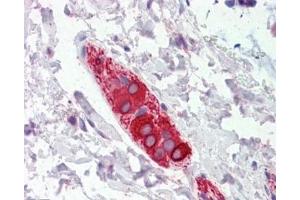 IHC testing of FFPE human colon tissue with FEZ1 antibody at 5ug/ml. (FEZ1 抗体)