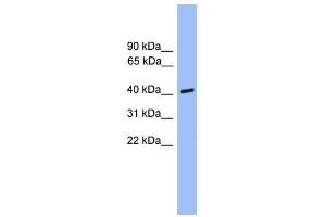 Western Blot showing CSNK1A1L antibody used at a concentration of 1-2 ug/ml to detect its target protein. (CSNK1A1L 抗体  (Middle Region))