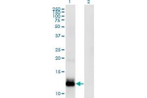 Western Blot analysis of WFDC5 expression in transfected 293T cell line by WFDC5 monoclonal antibody (M03), clone 5G5. (WFDC5 抗体  (AA 25-123))