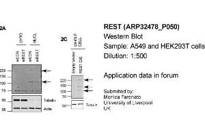 Western Blotting (WB) image for anti-RE1-Silencing Transcription Factor (REST) (Middle Region) antibody (ABIN2779670) (REST 抗体  (Middle Region))